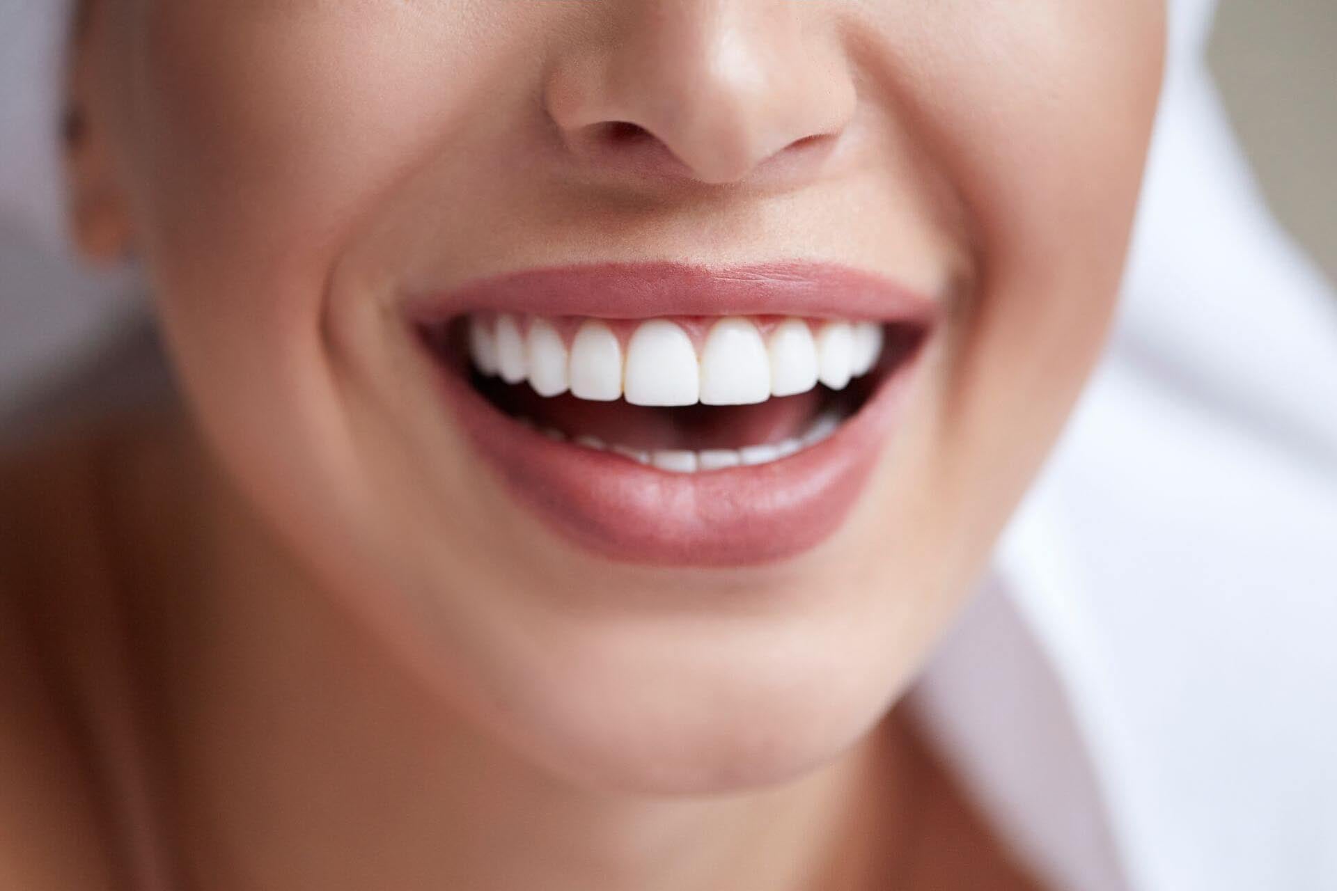 What a dental hygienist said about Glacier Teeth Whitening
